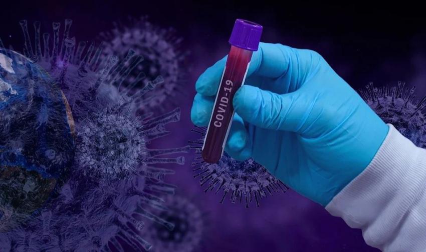 Miami Dade reporta 143 nuevos casos de coronavirus y 2 fallecidos más