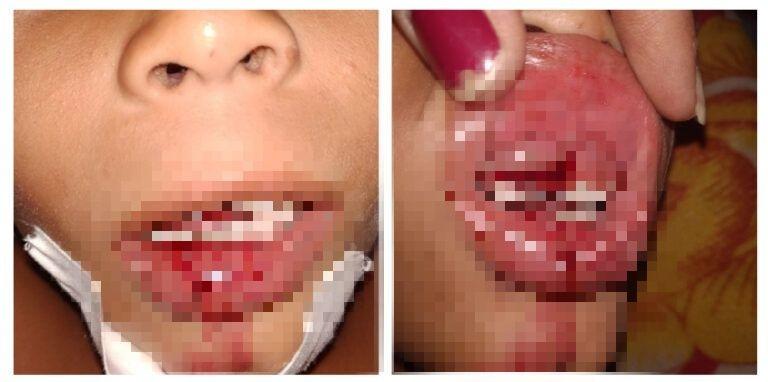 Madre cubana desesperada pide ayuda en las redes para encontrar medicamento para su niño