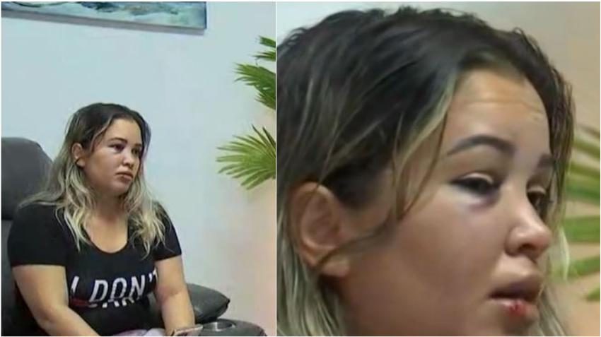 Joven cubana de Miami conductora de Uber es brutalmente golpeada por un pasajero