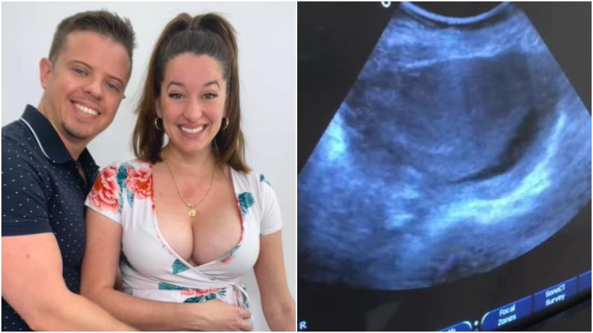 Actriz cubana Laura Treto anuncia que espera un hijo