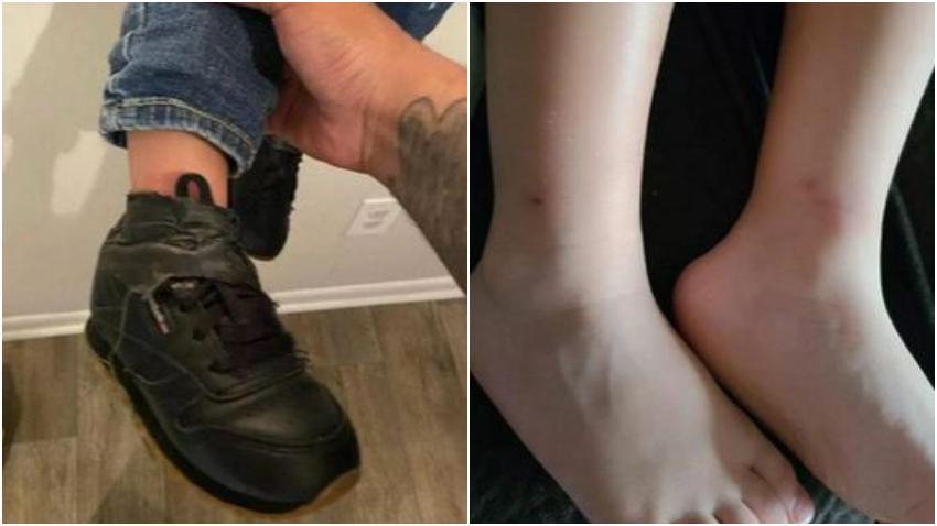Madre indignada al recoger a su hijo del daycare con los zapatos pegados con cinta adhesiva a sus tobillos